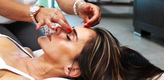 A woman receiving acupuncture treatment