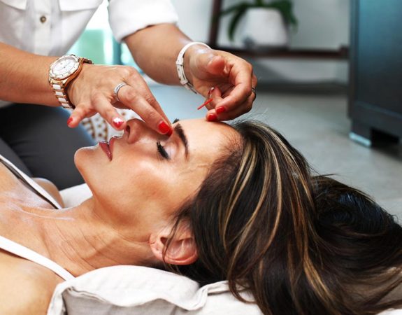 A woman receiving acupuncture treatment